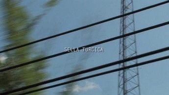 Sella Turcica 01
